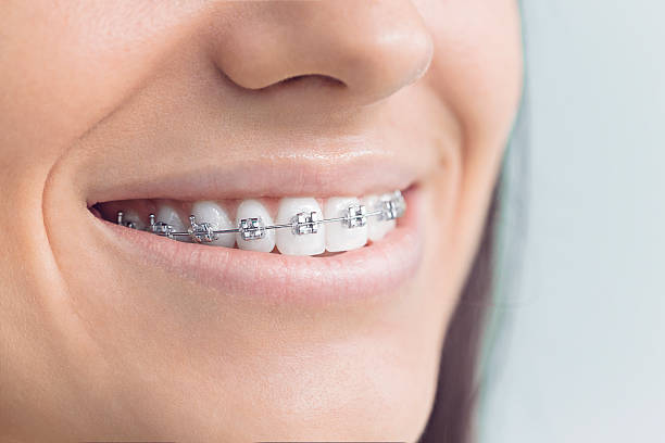 Laser Dentistry in Mount Ida, AR